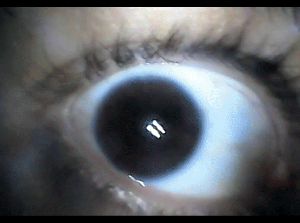 De Colon Isation part VI: inbodiesvisibleborders