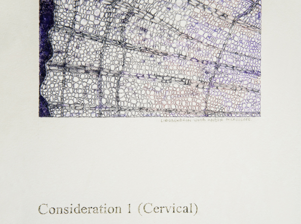 Time out of (skeletal) Joint: The Spineless don't Protest - Consideration 1